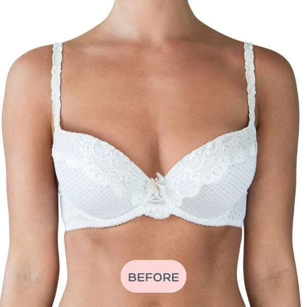 Evenly Bra Balancers™ are specifically designed bra fillers ...also known as breast forms, bra inserts, bra pads and prostheses. Light, and easy to wear in your regular bra on your smaller side, they create a smooth, natural, even appearance for uneven boobs. Available in 7 sizes to suit your shape.
