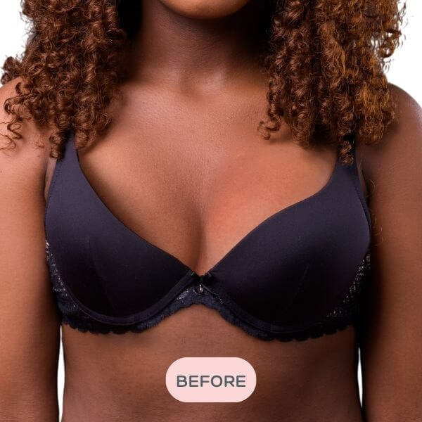 Evenly Bra Balancers™ are specifically designed bra fillers ...also known as breast forms, bra inserts, bra pads and prostheses. Light, and easy to wear in your regular bra on your smaller side, they create a smooth, natural, even appearance for uneven boobs. Available in 7 sizes to suit your shape.