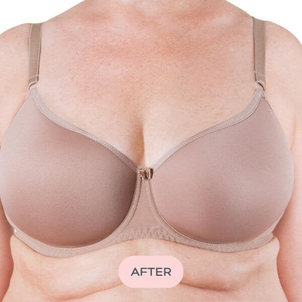 Evenly Bra Balancers™ are specifically designed bra fillers ...also known as breast forms, bra inserts, bra pads and prostheses. Light, and easy to wear in your regular bra on your smaller side, they create a smooth, natural, even appearance for uneven boobs. Available in 7 sizes to suit your shape.