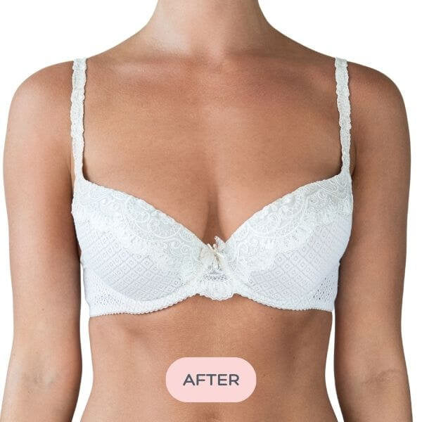 Evenly Bra Balancers™ are specifically designed bra fillers ...also known as breast forms, bra inserts, bra pads and prostheses. Light, and easy to wear in your regular bra on your smaller side, they create a smooth, natural, even appearance for uneven boobs. Available in 7 sizes to suit your shape.