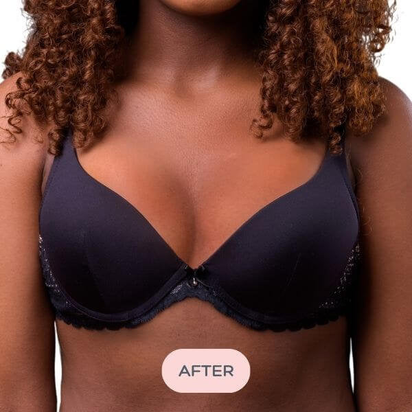 Evenly Bra Balancers™ are specifically designed bra fillers ...also known as breast forms, bra inserts, bra pads and prostheses. Light, and easy to wear in your regular bra on your smaller side, they create a smooth, natural, even appearance for uneven boobs. Available in 7 sizes to suit your shape.